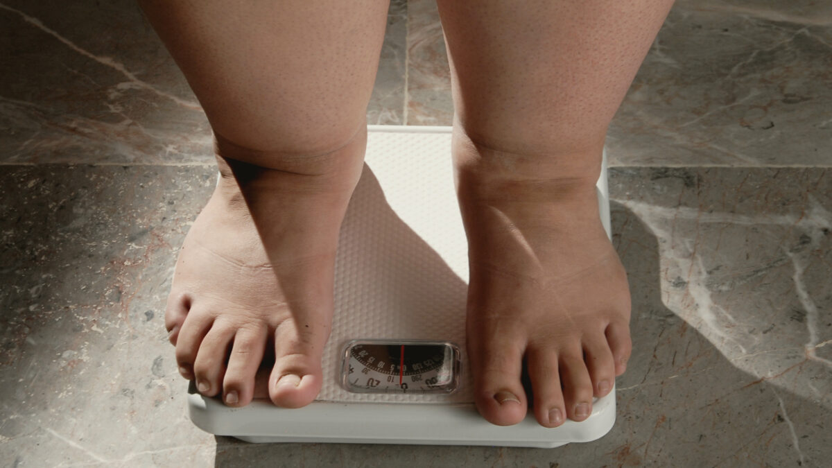 Obesidade cresce 118% no Brasil e já atinge 1 em cada 4 adultos, aponta pesquisa