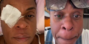 Cacau Protásio desabafa após perda de visão: ‘O barato sai caro’