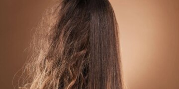 Não sabe como controlar o frizz? Dermatologista dá dicas infalíveis