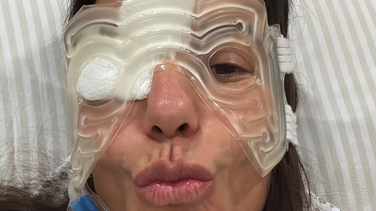 Ivete Sangalo mostra bom humor após cirurgia no rosto e brinca: “Cabeça de gelo”