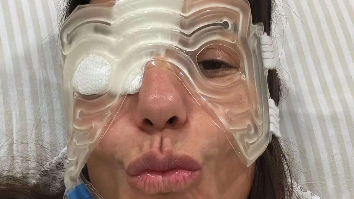 Ivete Sangalo mostra bom humor após cirurgia no rosto e brinca: “Cabeça de gelo”