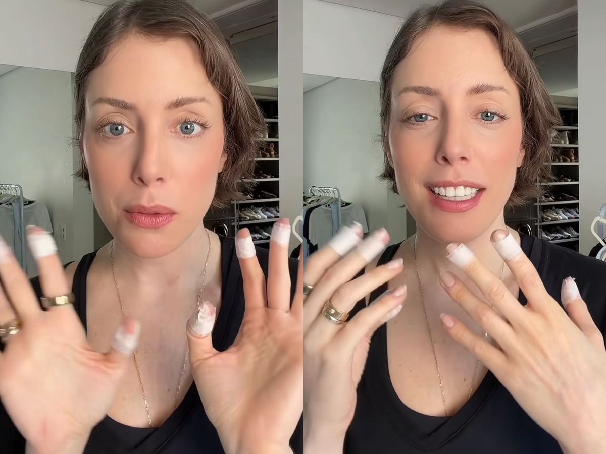 Fabiana Justus revela diagnóstico de transtorno que gera vontade de machucar a pele