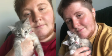 Mulher com barba diz se sentir mais bonita ao assumir pelos faciais