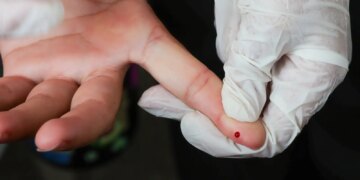 SUS passa a oferecer teste rápido de dengue