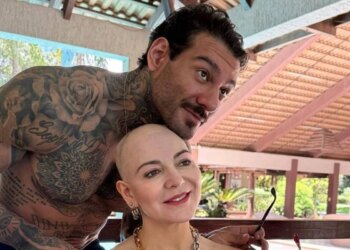 Mãe de Lucas Lucco mostra marcas de alopecia e desabafa