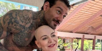 Mãe de Lucas Lucco mostra marcas de alopecia e desabafa