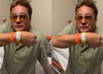 Leonardo leva tombo e olho roxo assusta