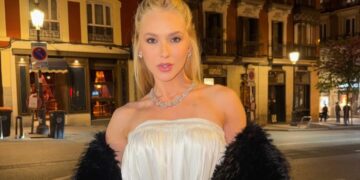 Virgínia revela tratamento com botox para enxaqueca