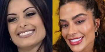 De minilifting a novo sorriso: veja mudanças no visual dos ex-BBBs