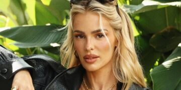 Yasmin Brunet mostra como controlou o lipedema