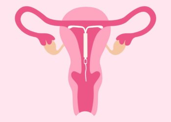 Sexo e DIU: o guia para retomar a intimidade com segurança