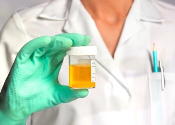 Nefrologista aponta 6 sinais no xixi que indicam problemas de saúde