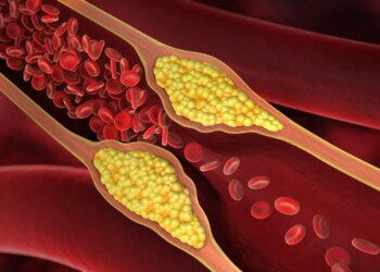 Os 3 passos para baixar o colesterol ruim naturalmente, segundo médico