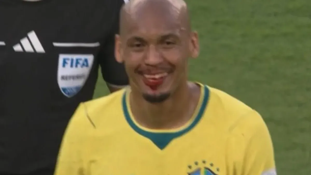 Fabinho deixa campo com rosto sangrando após choque na estreia da Copa do Mundo