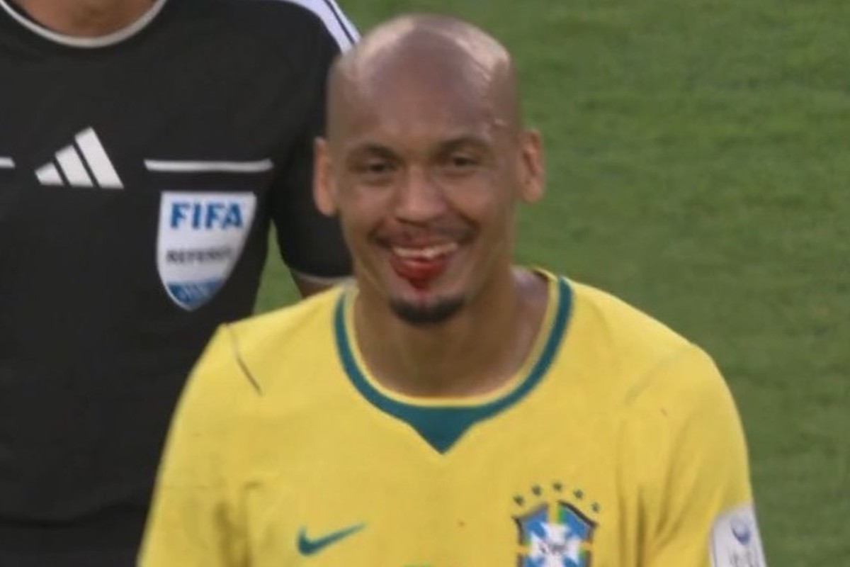 Fabinho deixa campo com rosto sangrando após choque na estreia da Copa do Mundo