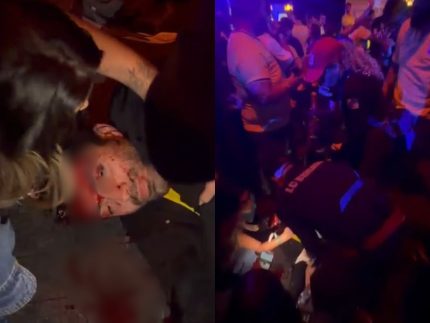 Organização do evento no Jockey Club nega superlotação após jovem ser agredido