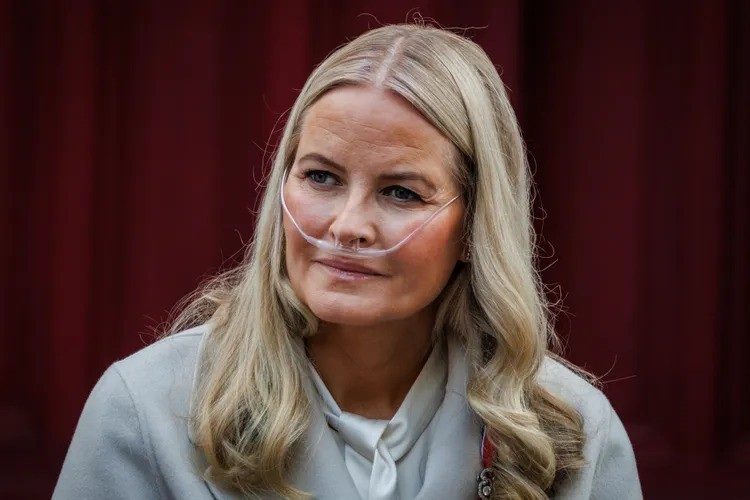 Princesa Mette-Marit da Noruega realiza transplante de pulmão em meio a crise familiar