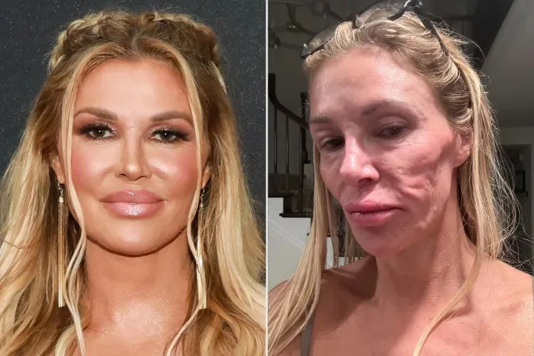 Brandi Glanville pede mais exames e critica médicos por desfiguração facial inexplicável