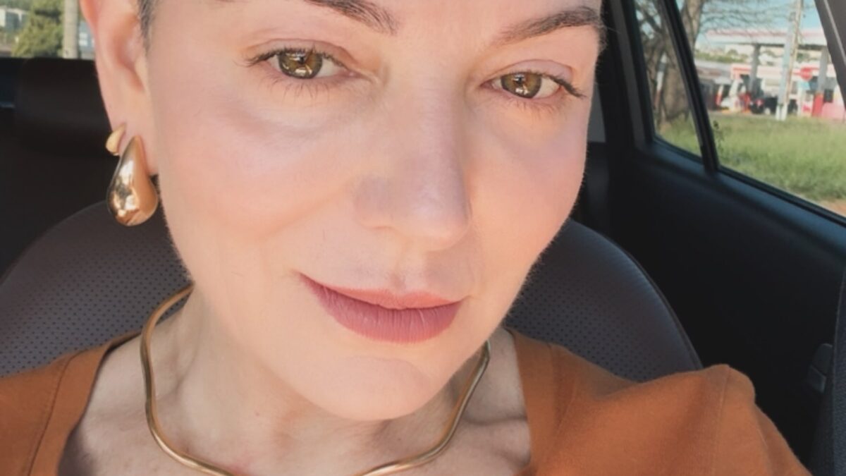 Karina Lucco reflete sobre confiança após nova queda de cabelo por alopecia