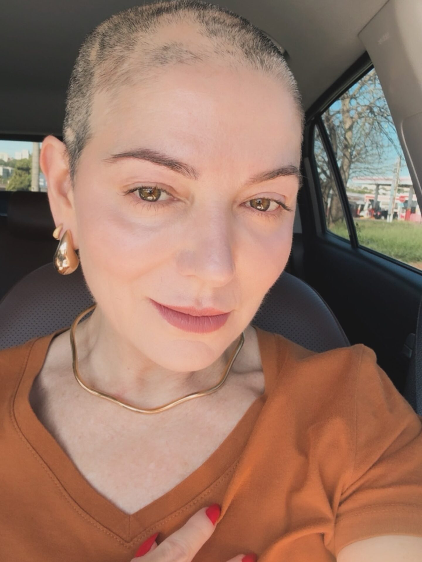 Karina Lucco reflete sobre confiança após nova queda de cabelo por alopecia