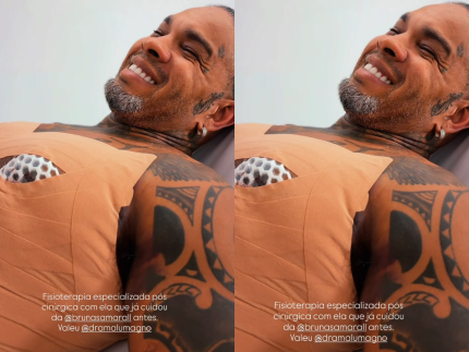 Rodriguinho realiza cirurgias plásticas após emagrecer mais de 20 kg e melhorar saúde