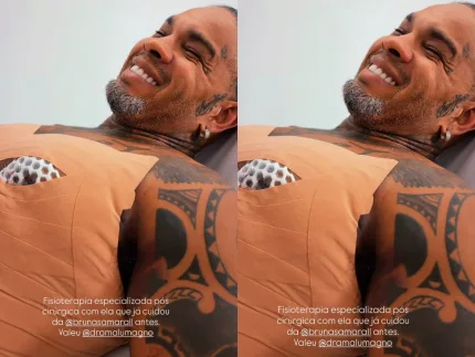 Rodriguinho realiza cirurgias plásticas após emagrecer mais de 20 kg e melhorar saúde