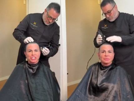 Gretchen raspa a cabeça ao vivo antes de transplante capilar por alopecia severa