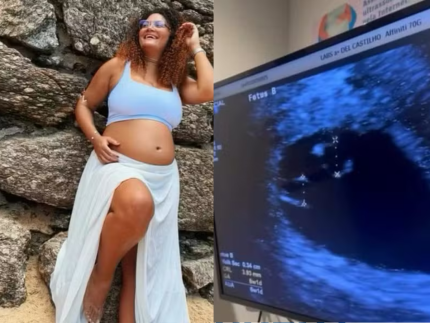 Mulher engravida de terceiro bebê durante gestação de gêmeos no RJ